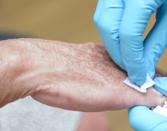 Dermatologist tends to an older person's hand